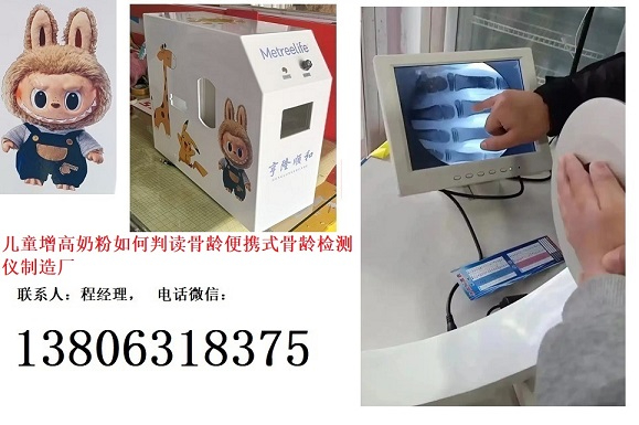 營養(yǎng)健康規(guī)劃兒童成長奶粉如何判讀骨齡便攜式骨齡檢測儀制造廠